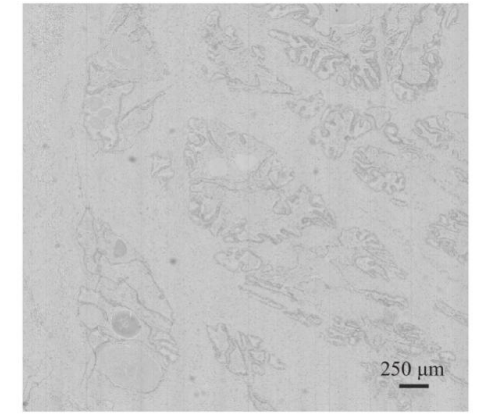 鑫圖sCMOS相機(jī) | 全自動推掃式高光譜顯微成像系統(tǒng)設(shè)計與研究